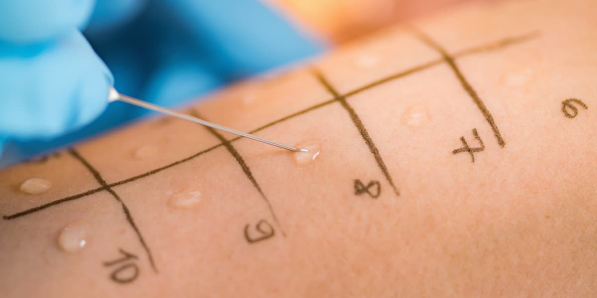 Allergietest Wien – Privat und Professionell in Ihrer HNO-Praxis
